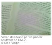 La DMLA affecte la vision centrale