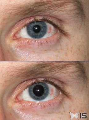 Les muscles de l'iris se contractent ou se relâchent pour changer le diamètre de la pupille