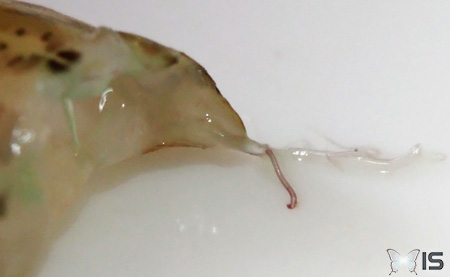 Des vers ont parasités l'organisme et sont visibles sur les organes du cadavre
